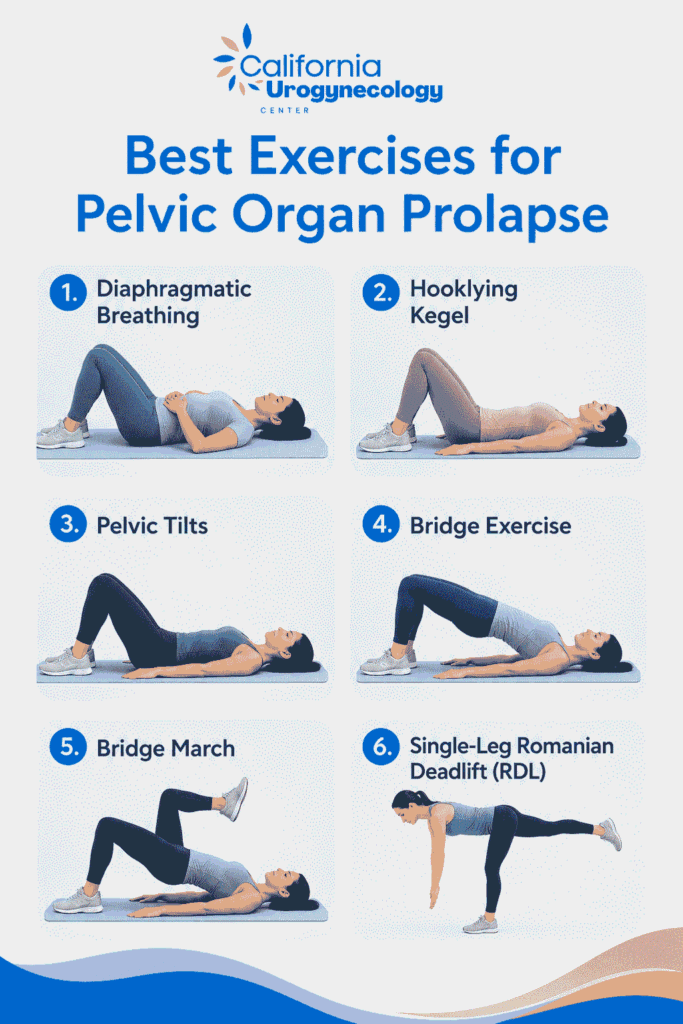 Best Exercises for Pelvic Organ Prolapse