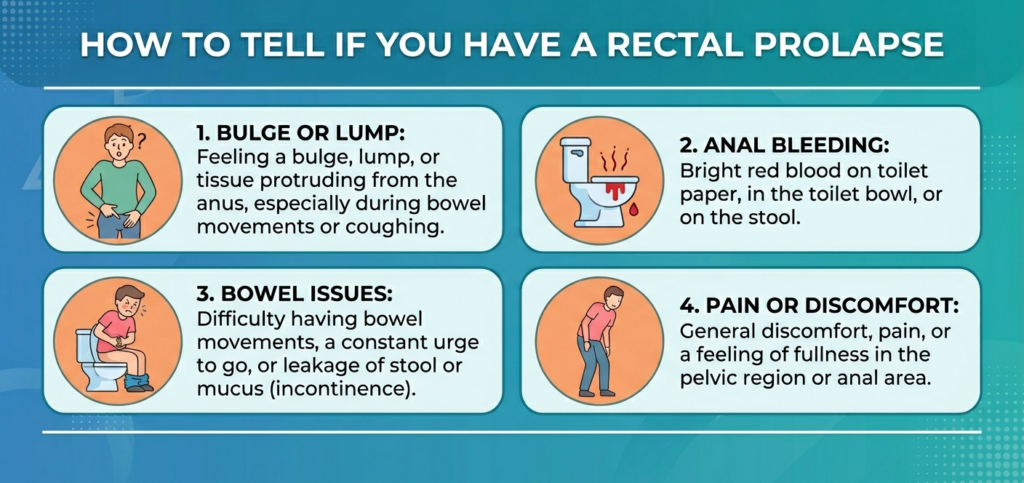 How to Tell If You Have a Rectal Prolapse?