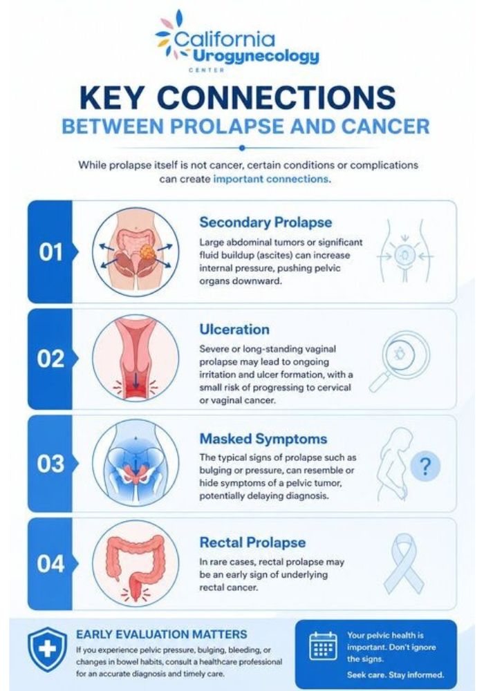 Key Connections Between Prolapse and Cancer