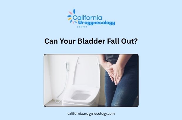 Can Your Bladder Fall Out? - California Urogynecology Center