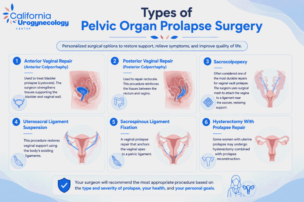 Types of Pelvic Organ Prolapse Surgery
