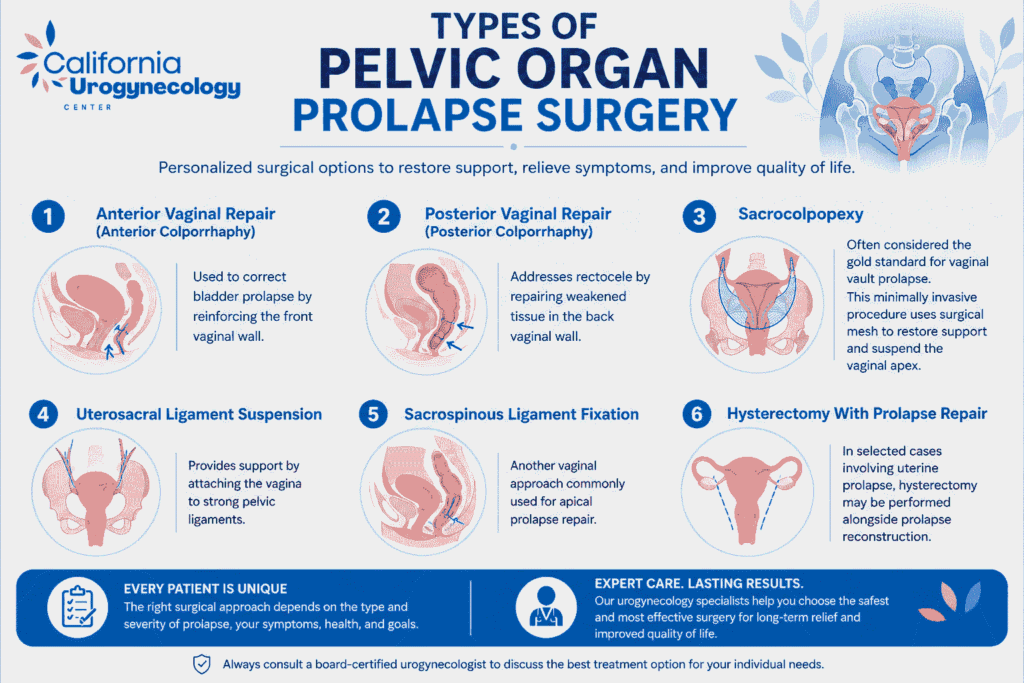 Types of Pelvic Organ Prolapse Surgery