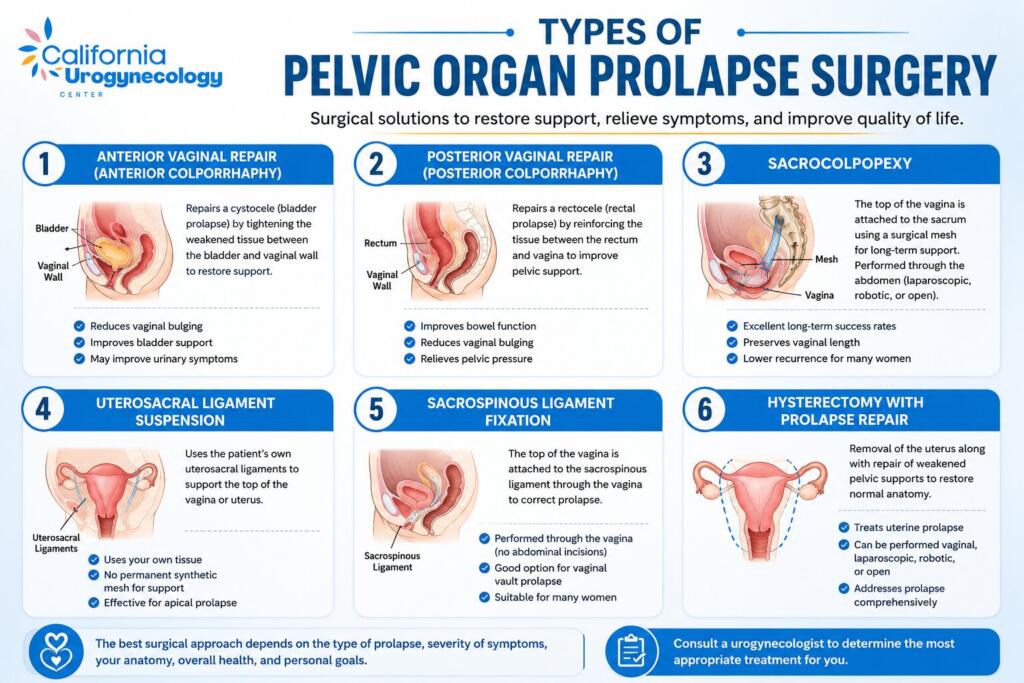Types of Pelvic Organ Prolapse Surgery